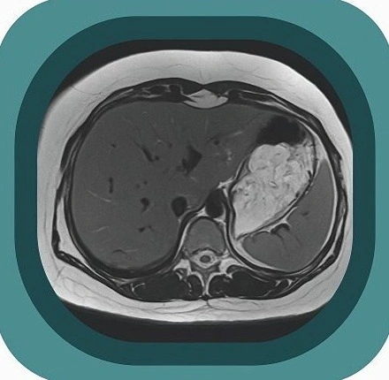 MRI abdomen anatomy icon